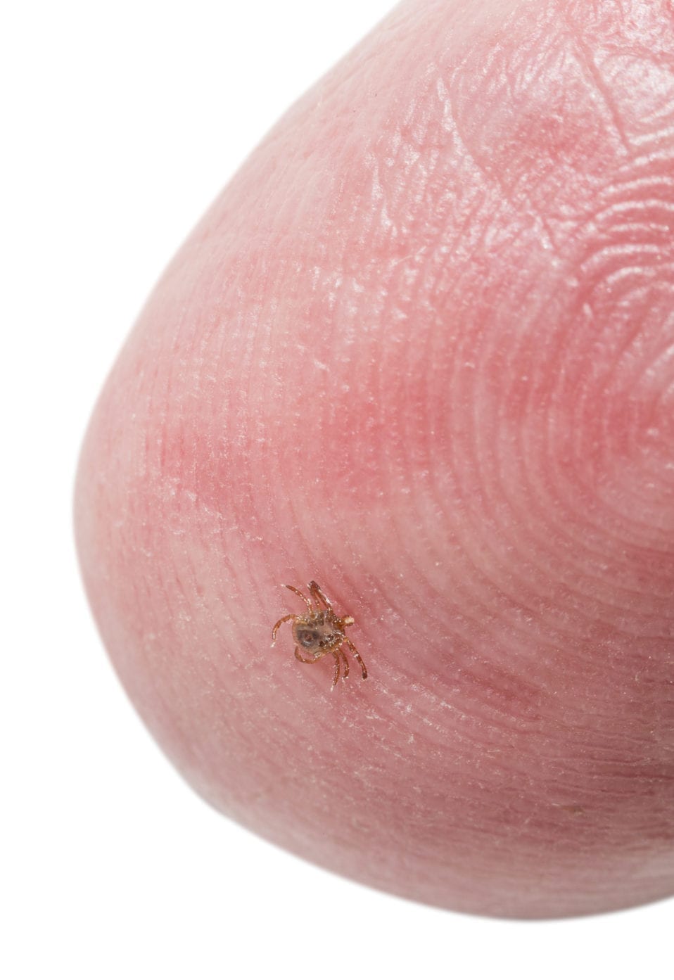 Tiny Deer Tick On Finger Tip Of Man • Minnesota Lyme Association